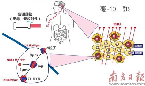 狙杀癌细胞第20945版：深读周刊·科技能见度2023 08 03南方日报数字报南方网