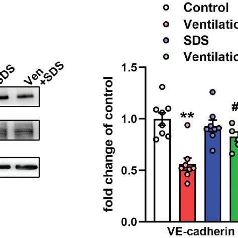 Effects Of Salidroside On The NF JB MMP 9 Pathway In The Model Of