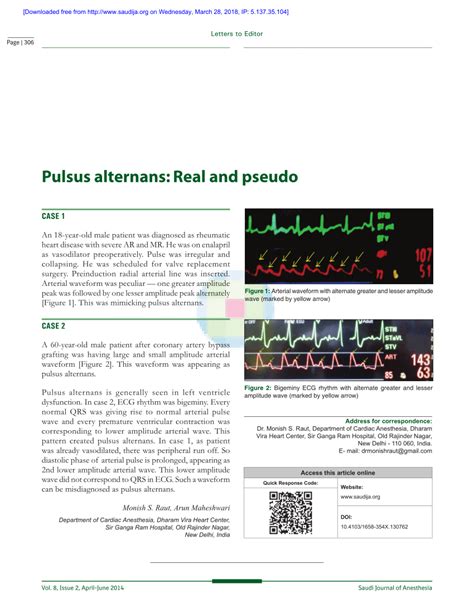 PDF Pulsus Alternans Real And Pseudo