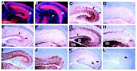 Control Of Hippocampal Morphogenesis And Neuronal Differentiation By