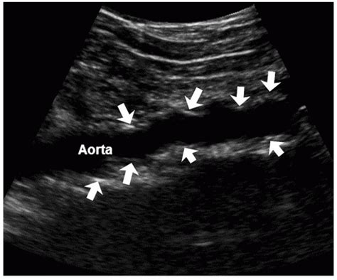 Vascular Structures Radiology Key