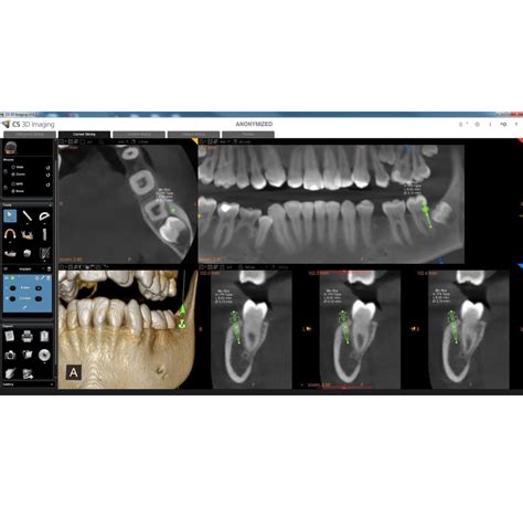 Software Cs Imaging V Suite Ad Medical