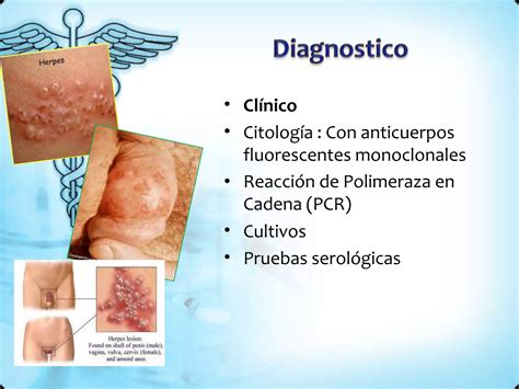 Infecciones Del Tracto Genital Inferior Ppt