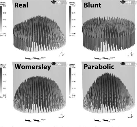 Figure From Effect Of Inlet Velocity Profiles On Patient Specific