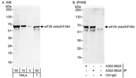 EIF2B Delta EIF2B4 Antibody A302 982A