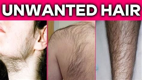 How To Remove Unwanted Hair Permanently At Home Naturally Beat Beauty Tips Unwanted Hair