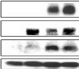 Expression Of Type Ii Transforming Growth Factor B Receptor T B Rii