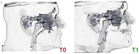 Jcm Free Full Text Upper Airway Characteristics And Morphological