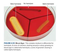 Answered: Beta hemolysis No hemolysis Alpha… | bartleby