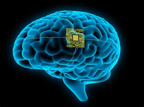 ASU Professor On The Plausibility Of Elon Musk S Brain Implant Plans