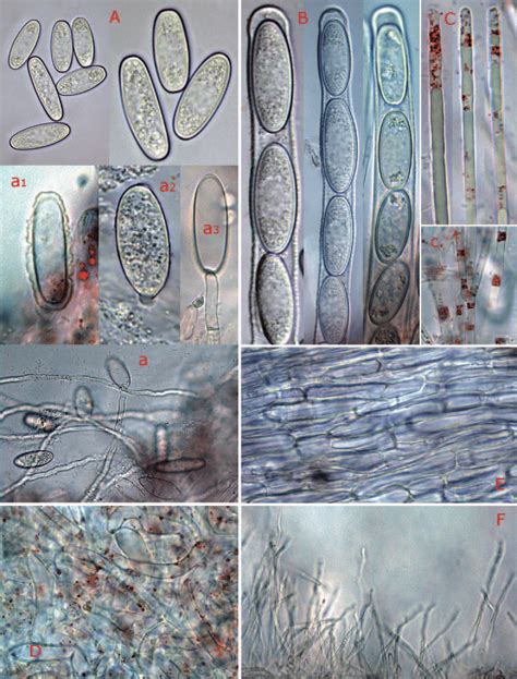 − Sarcoscypha Coccinea Photos B Perić A− Ascospores A −