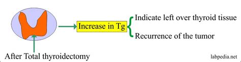 Tumor Marker Part 10 Thyroglobulin Tg As Tumor Marker