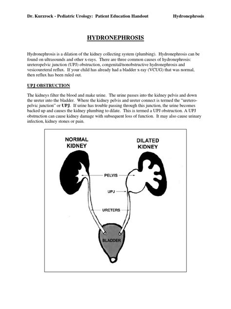 Hydronephrosis Dr Kurzrock Pediatric Urology Patient Education Handout Hydronephrosis