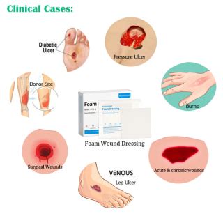 Supply Medical Wound Care Foam Dressing Wholesale Factory - Guangzhou Rainhome Pharm & Tech Co., Ltd