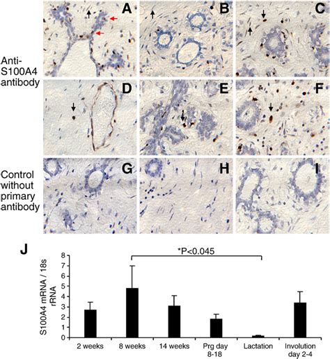 Expression Of S A In Normal Mammary Gland Representative