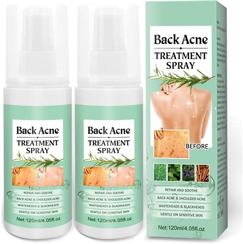 Amazon Back Acne Treatment Back Acne Spray Ml Salicylic Acid