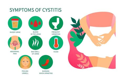 Urinary Tract Infections Dr Fatemah Aghansiri Aster Clinic