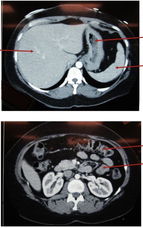 Digestive Ct Scan 1 Diagram Quizlet