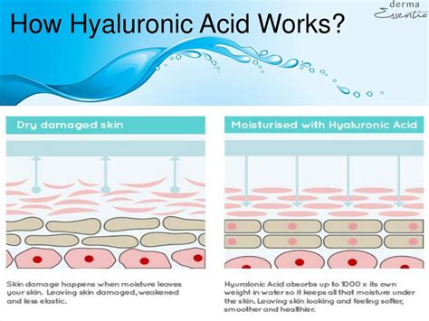 How Does Hyaluronic Acid Work At Roy Barnard Blog