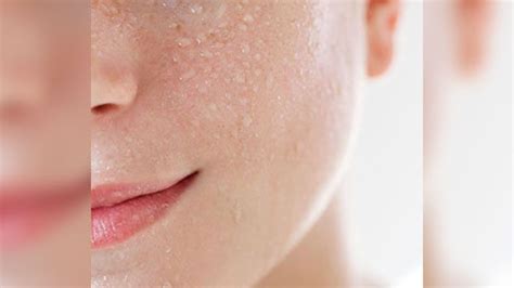 peeling skin estetica beauty