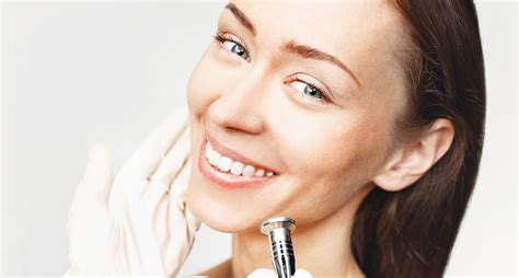 Is Microdermabrasion an Effective Treatment for Acne Scars