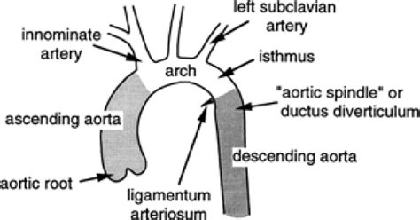 Aorta Arch Vessels And Great Veins Thoracic Key