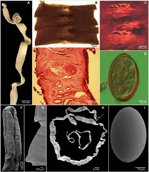 Morphology of Diphyllobothrium dendriticum . (A–E, G, H) Human case... | Download Scientific Diagram