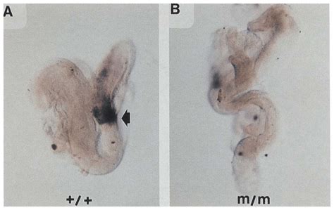 Whole Mount In Situ Hybridization Analysis Of Notchl Expression In