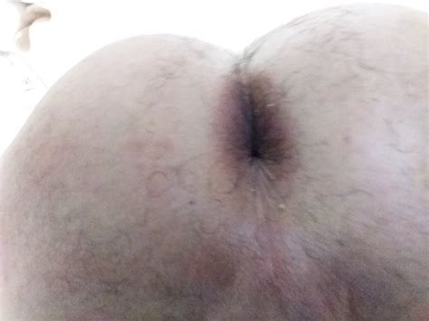 Man Ass Asshole Page XNXX Adult Forum