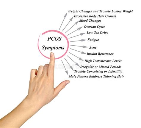 Symptoms of Polycystic Ovary Syndrome Stock Photo - Image of baldness ...