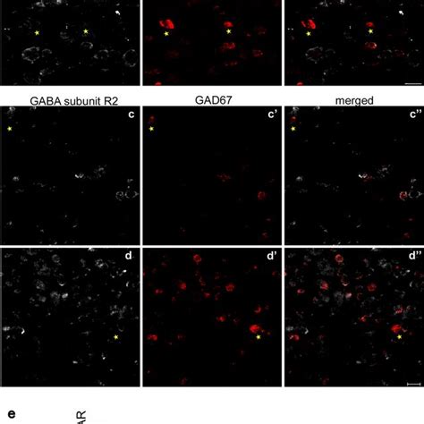 Colocalization Of Gaba Subunit γ2 And Gabab R2 With Vglut2 Mrna