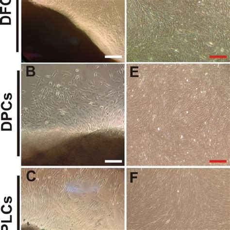 Morphology Of Primary Cultures Of Human Dental Follicle Cells DFCs