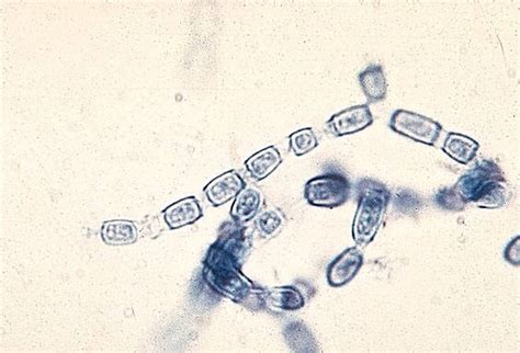 Micologia Easd Coccidioides Immitis