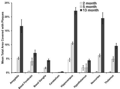 Quantification of β amyloid Aβ plaque burden in different brain