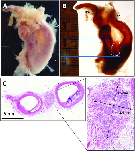 Carotid Bifurcation From Group A Specimen Ii A Dorsal View Of A Right Download Scientific