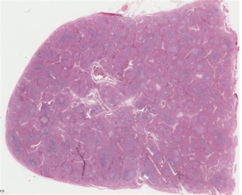 A Lab Exam Spleen Flashcards Quizlet