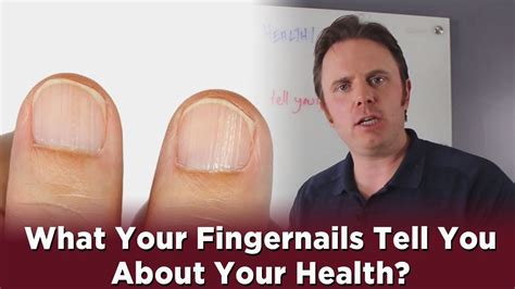 What Your Fingernails Tell You About Your Health Youtube