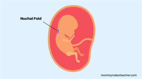 13 Weeks Pregnant Ultrasound Nuchal Translucency Scan Mommy Maker