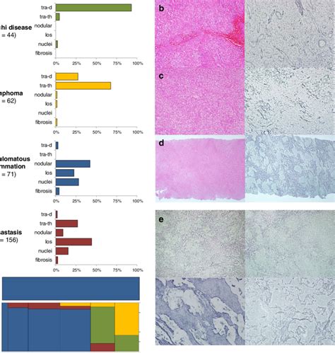 a The reticulin staining patterns of individual etiology. X-axis ...