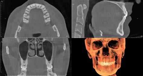 How Does Cone Beam Ct Work The Best Picture Of Beam