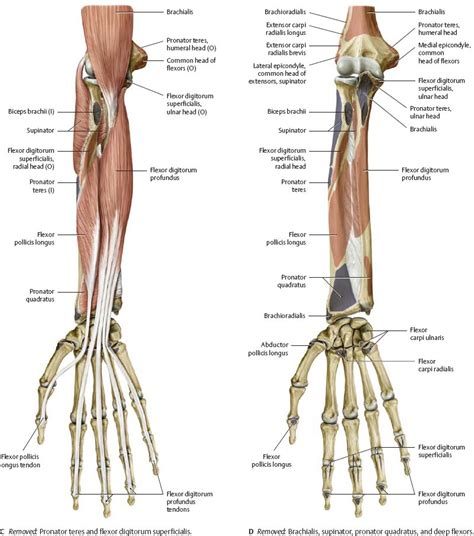 Picture Of Forearm Tendons : Tennis and Golfers elbow - What's the difference? - STT ... - They ...