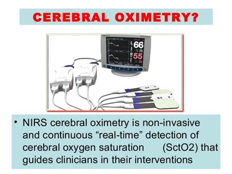 Cerebral Oximetry Brain Protection In Cardiac Surgery