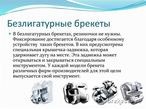 Назначение брекет-системы - презентация онлайн
