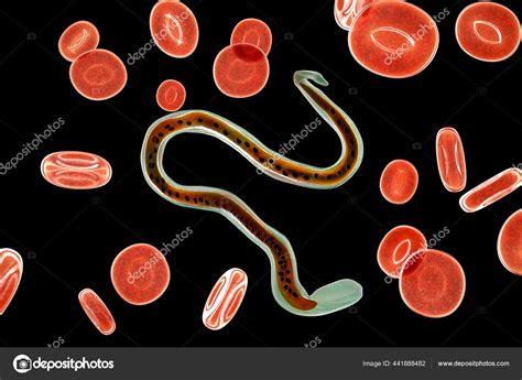 Wuchereria Bancrofti Roundworm Nematode One Causative Agents Lymphatic Filariasis Illustration