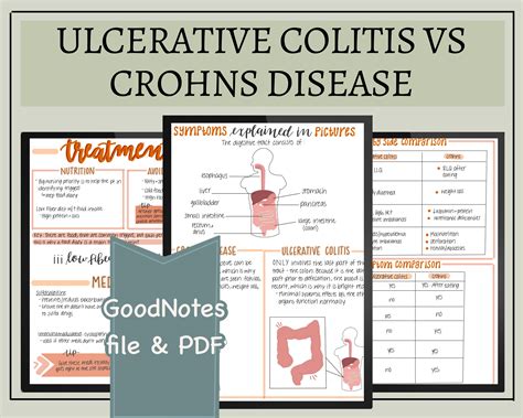 Ulcerative Colitis Vs Crohns Disease Nursing Notes Digital Download Goodnotes File And Pdf