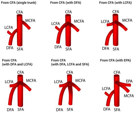 Medial Circumflex Femoral Artery Branches