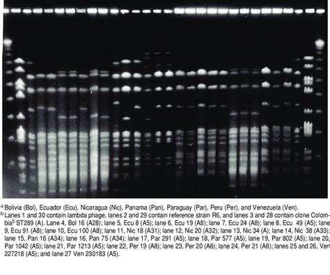 Pulsed Field Gel Electrophoresis Band Patterns Of Invasive Download Scientific Diagram