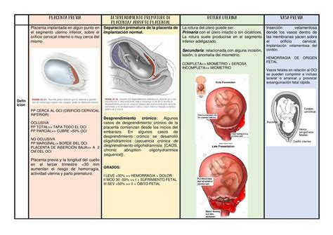 Hemorragias De La Segunda Mitad Del Embarazo Udocz