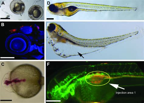 Phenotype Based Drug Discovery Endpoints For Zebrafish Based Screening