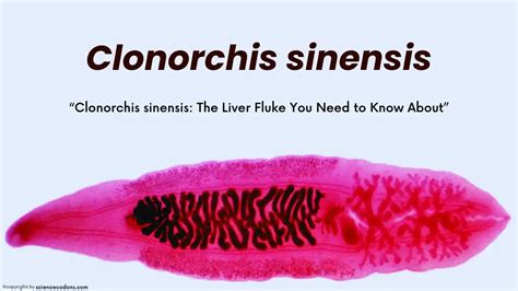 Clonorchis sinensis Infection2025: Symptoms, Diagnosis, and Treatment ...